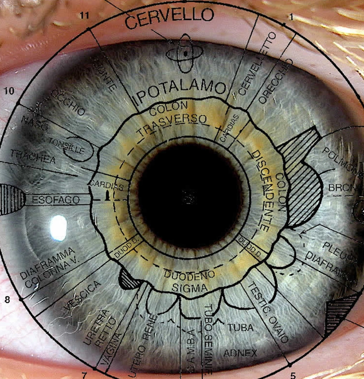 iridologia - yo soy salud iridologia - yo soy salud
